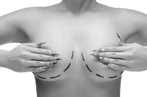 Breast Reduction