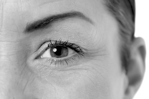 Eyelid Surgery