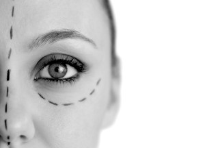 Face Lift